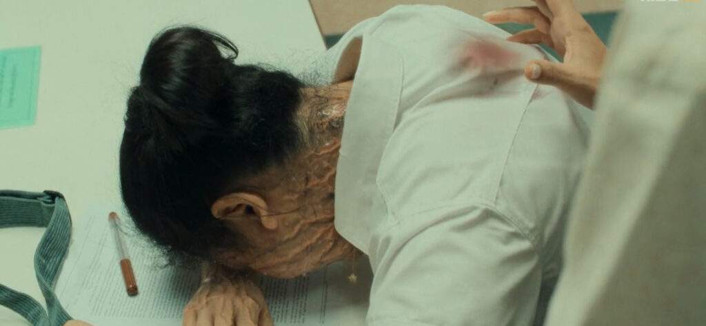 Zomvivor EP 7 Photo 1